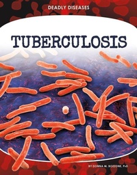 Enlarge image Cover: Tuberculosis - Core Library