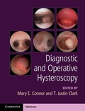 Cover: Diagnostic and Operative Hysteroscopy - Cambridge University Press