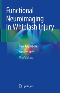 Abbildung von: Functional Neuroimaging in Whiplash Injury - Springer