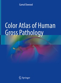 Abbildung von: Color Atlas of Human Gross Pathology - Springer