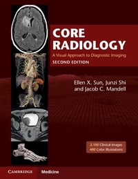 Abbildung von: Core Radiology - Cambridge University Press