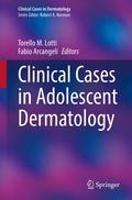 Cover: Clinical Cases in Adolescent Dermatology - Springer