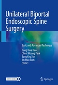 Bild: Unilateral Biportal Endoscopic Spine Surgery - Springer