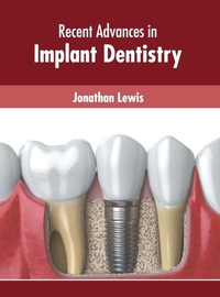 Abbildung von: Recent Advances in Implant Dentistry - Murphy & Moore Publishing