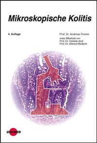 Abbildung von: Mikroskopische Kolitis - UNI-MED