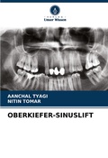 Cover: OBERKIEFER-SINUSLIFT - Verlag Unser Wissen