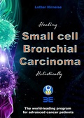 Cover: Small cell bronchial carcinoma - Publishdrive