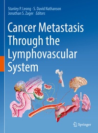 Abbildung von: Cancer Metastasis Through the Lymphovascular System - Springer