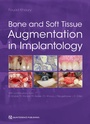 Cover: Bone and Soft Tissue Augmentation in Implantology - Quintessenz Verlag