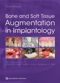 Cover: Bone and Soft Tissue Augmentation in Implantology - Quintessenz Verlag