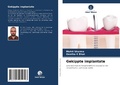 Cover: Gekippte implantate - Verlag Unser Wissen