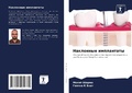 Cover: Naklonnye implantaty - Sciencia Scripts