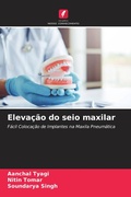 Cover: Eleva&ccedil;&atilde;o do seio maxilar - Edi&ccedil;&otilde;es Nosso Conhecimento