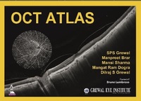 Enlarge image Cover: OCT Atlas - Jaypee Brothers Medical Publishers