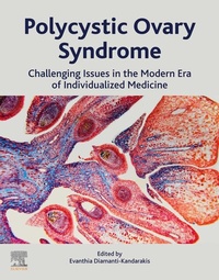 Abbildung von: Polycystic Ovary Syndrome - Elsevier