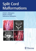 Bild: Split Cord Malformations - Thieme
