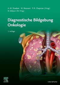 Abbildung von: Diagnostische Bildgebung Onkologie - Urban & Fischer