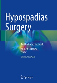 Abbildung von: Hypospadias Surgery - Springer