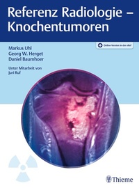 Abbildung von: Referenz Radiologie - Knochentumoren - Thieme