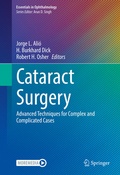 Cover: Cataract Surgery - Springer