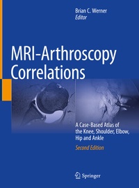Abbildung von: MRI-Arthroscopy Correlations - Springer