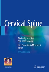 Abbildung von: Cervical Spine - Springer