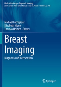 Abbildung von: Breast Imaging - Springer