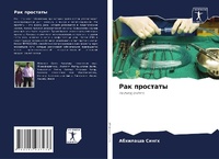 Enlarge image Cover: Rak prostaty - Sciencia Scripts
