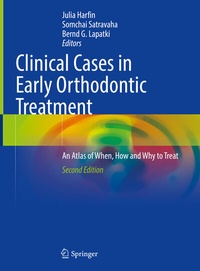 Abbildung von: Clinical Cases in Early Orthodontic Treatment - Springer