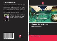 Enlarge image Cover: Câncer de próstata - Edições Nosso Conhecimento