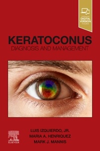 Abbildung von: Keratoconus - Elsevier