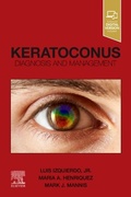 Cover: Keratoconus - Elsevier