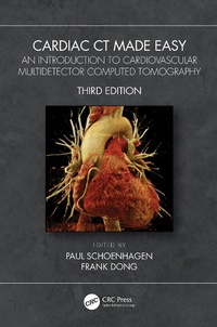 Abbildung von: Cardiac CT Made Easy - CRC Press