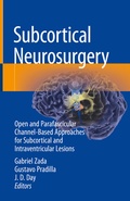 Abbildung von: Subcortical Neurosurgery - Springer
