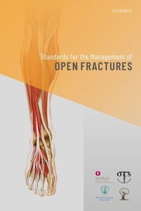 Abbildung von: Standards for the Management of Open Fractures - OUP eBook