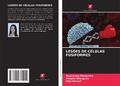Cover: LES&Otilde;ES DE C&Eacute;LULAS FUSIFORMES - Edi&ccedil;&otilde;es Nosso Conhecimento