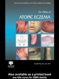 Cover: An Atlas of Atopic Eczema - CRC Press