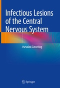 Abbildung von: Infectious Lesions of the Central Nervous System - Springer