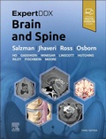 Cover: ExpertDDx: Brain and Spine - Churchill Livingstone