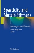 Abbildung von: Spasticity and Muscle Stiffness - Springer