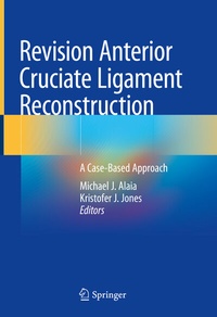 Abbildung von: Revision Anterior Cruciate Ligament Reconstruction - Springer