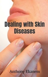 Abbildung von: Dealing with Skin Diseases - Notion Press, Inc.