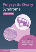 Cover: Polycystic Ovary Syndrome - Cambridge University Press