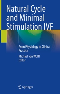Abbildung von: Natural Cycle and Minimal Stimulation IVF - Springer