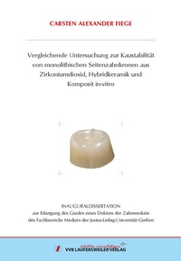 Abbildung von: Vergleichende Untersuchung zur Kaustabilität von monolithischen Seitenzahnkronen aus Zirkoniumdioxid, Hybridkeramik und Komposit in-vitro - VVB Laufersweiler Verlag