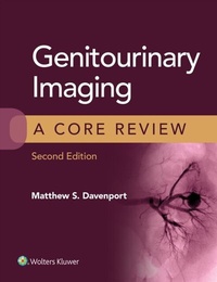 Abbildung von: Genitourinary Imaging: A Core Review - Wolters Kluwer Health