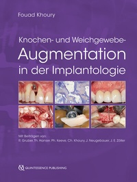 Abbildung von: Knochen- und Weichgewebeaugmentation in der Implantologie - Quintessenz Verlag