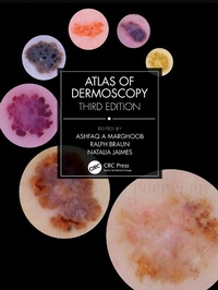 Abbildung von: Atlas of Dermoscopy - CRC Press