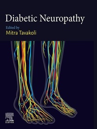 Abbildung von: Diabetic Neuropathy - Elsevier
