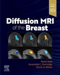 Cover: Diffusion MRI of the Breast - Elsevier